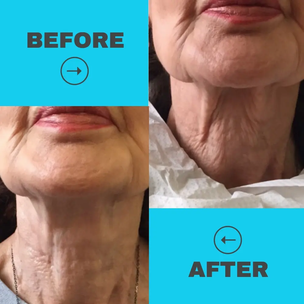 8-Hour Peptide Firming Mask - Image 3
